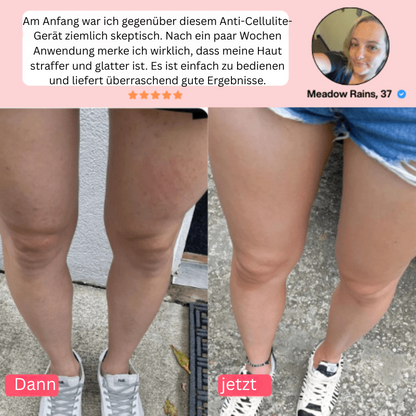 Velvèra – Für ein neues Hautgefühl